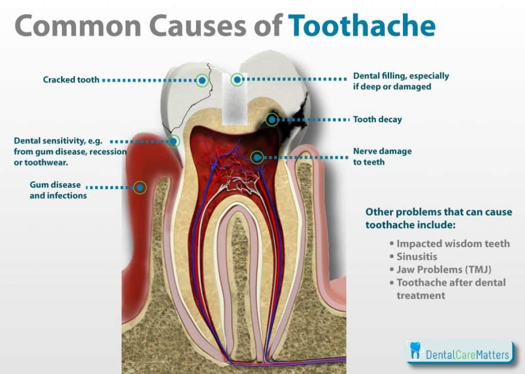 here-s-how-to-cure-your-toothache-in-literally-seconds-you-can-thank