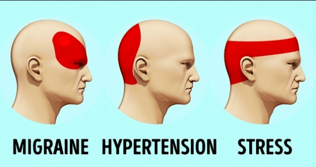 headaches, acupressure, pressure points