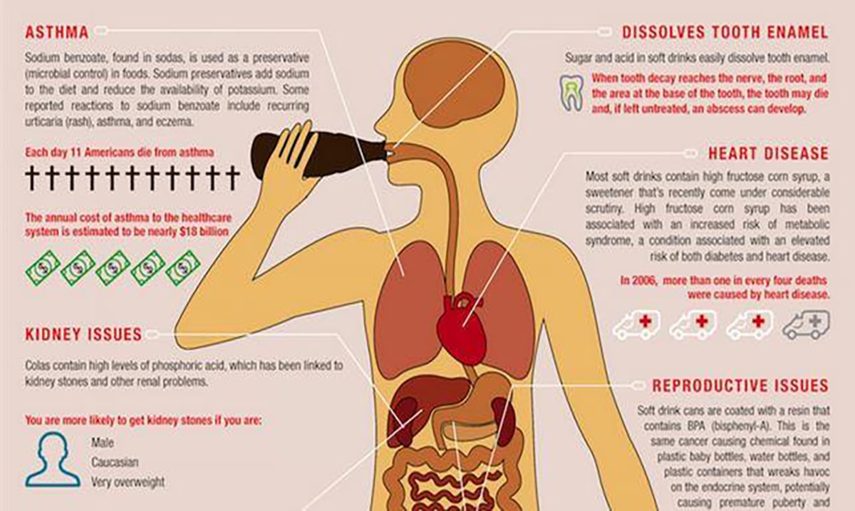 What Happens To Your Body When You Drink Soda Infographic Natural 