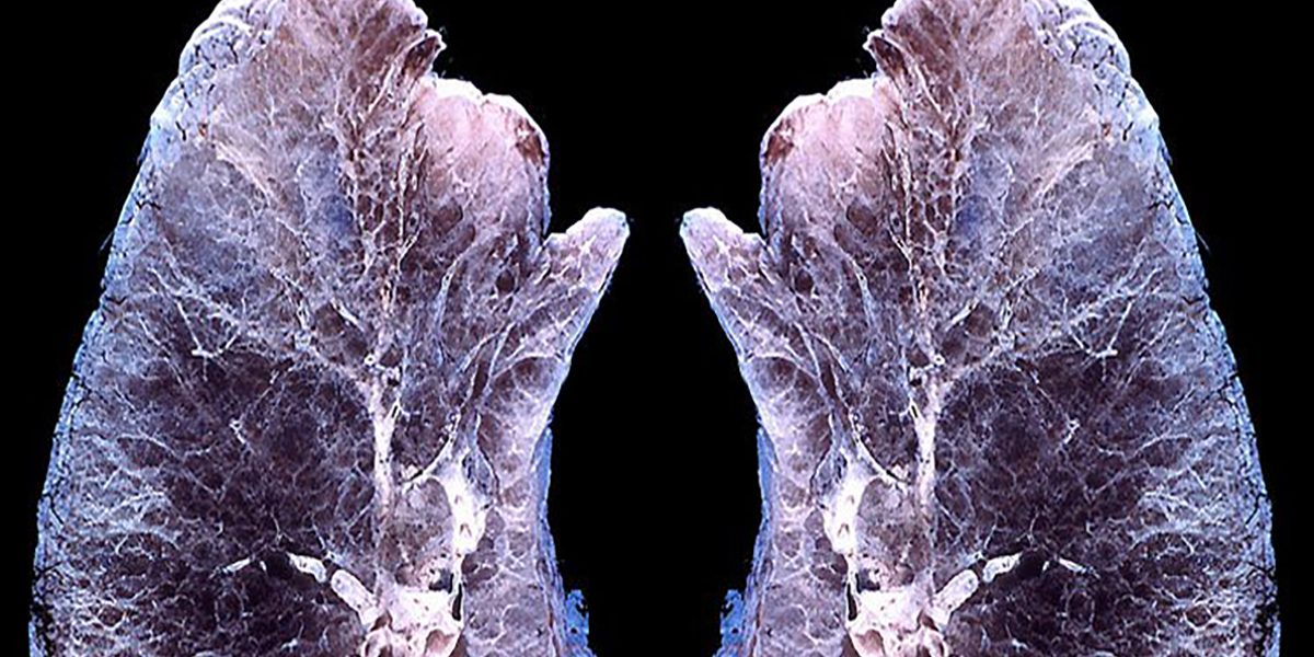 This is What Happens to Your Lungs and Air when You Inhale Essential ...