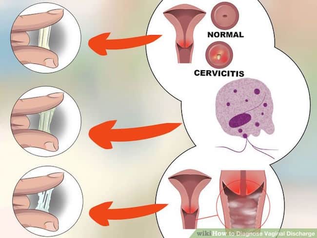 vaginal discharge, reproductive