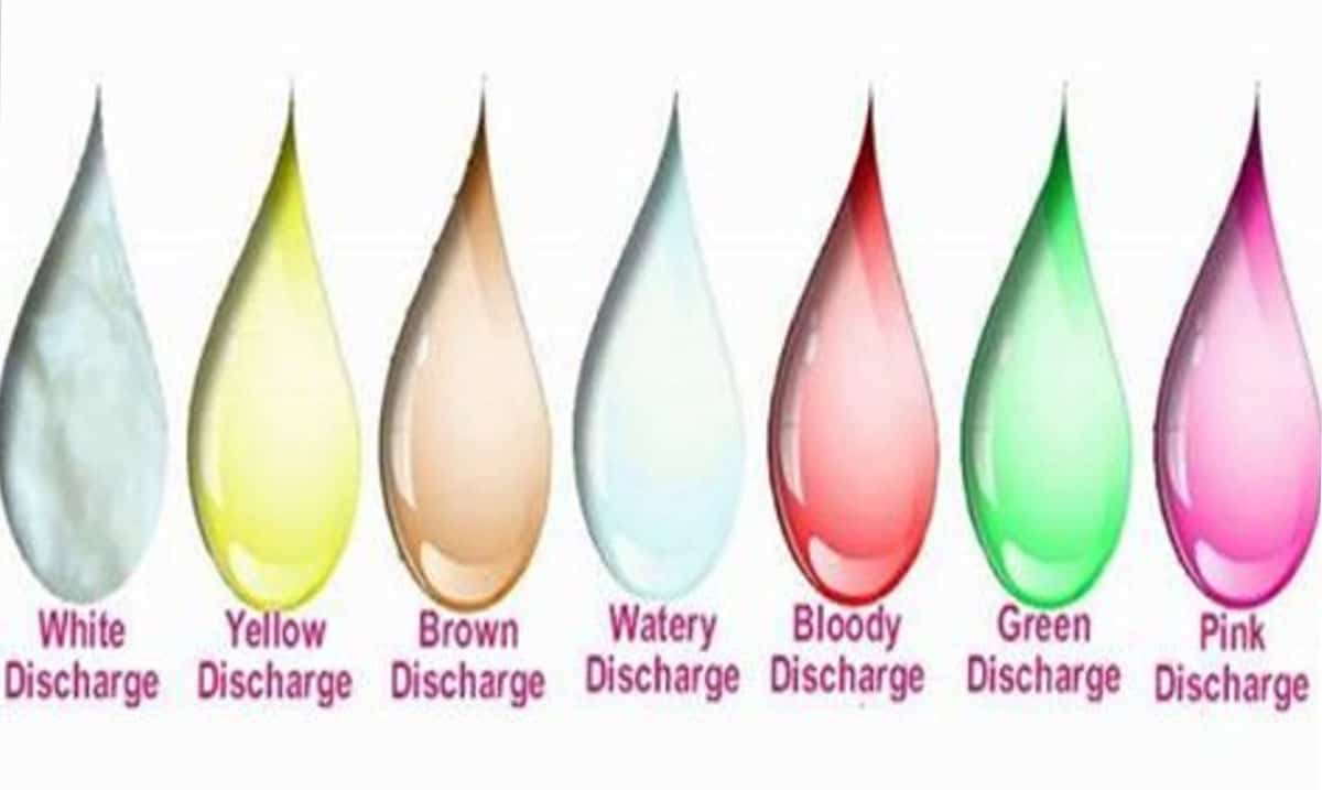 discharge colors