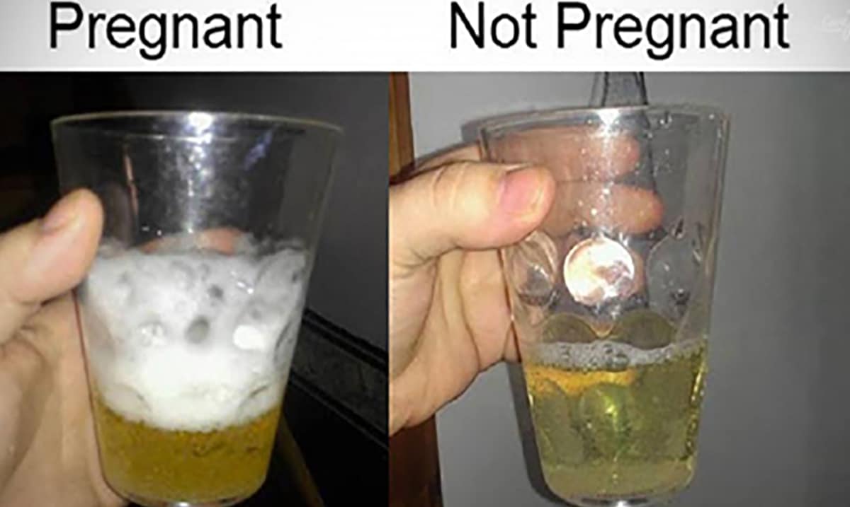 Забеременела содой. Тест на беременность с содой. Тест на беременность с йодом и мочой. Сода и моча тест на беременность. Беременность йод и моча.