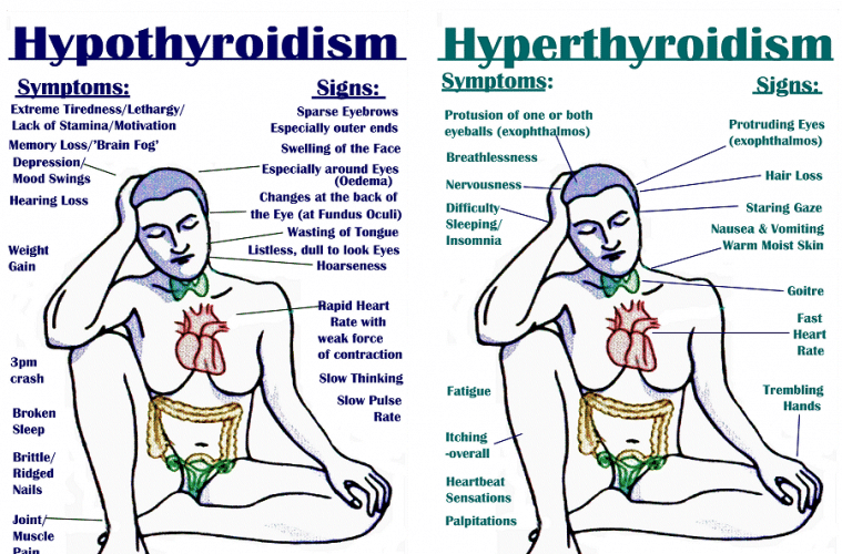 thyroid, hypothyroidism, thyroid disease