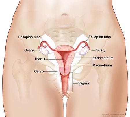 cancer, ovarian cancer, signs of ovarian cancer
